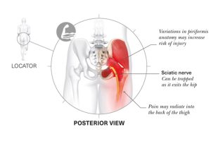 Lesiones-más-frecuentes-en-corredores-vitalmente-Imagen-008