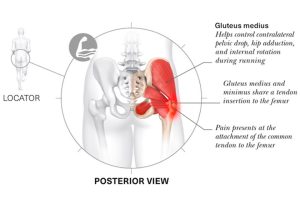 Lesiones-más-frecuentes-en-corredores-vitalmente-Imagen-009
