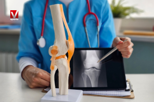 viscosuplementación de rodilla en vitalmente sports (5)